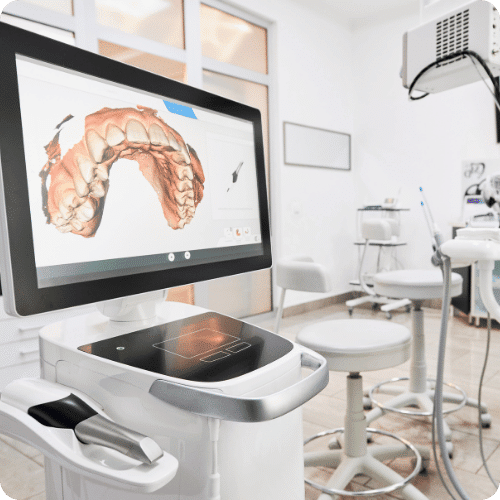 Intra-Oral Scanner