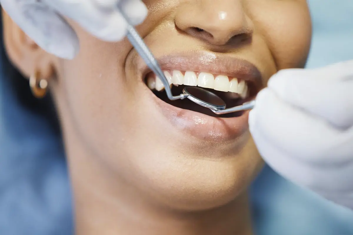 DENTAL CHECKUPS