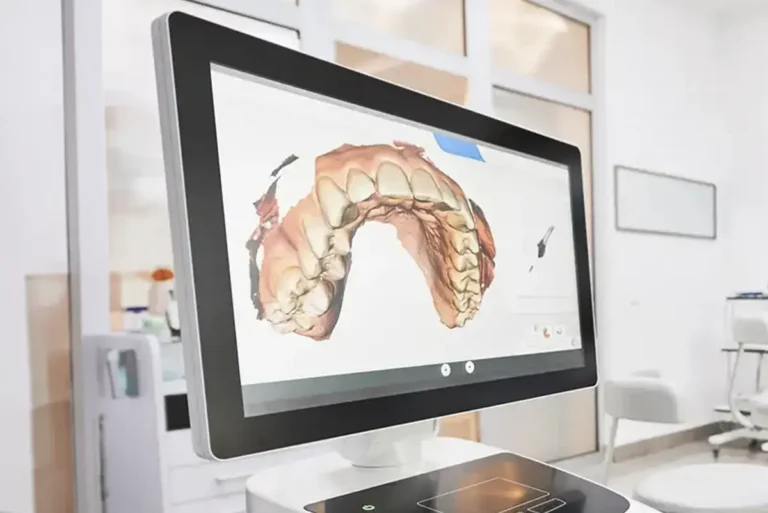Digital Scanner Creating 3D models of Teeth at Cinco Ranch Dental in Katy, TX