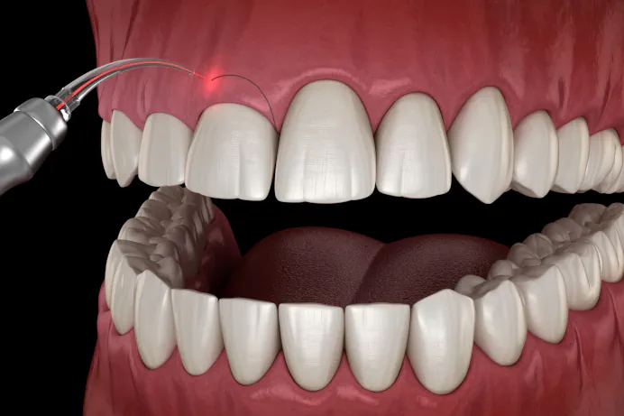 TOOTH RESHAPING AND CONTOURING
